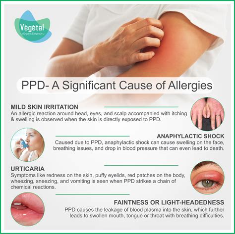 Ppd A Significant Cause Of Allergies Hair Dye Allergy Skincare Ingredients Skin Care