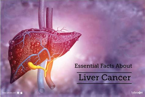 Essential Facts About Liver Cancer By Dr Garima Lybrate