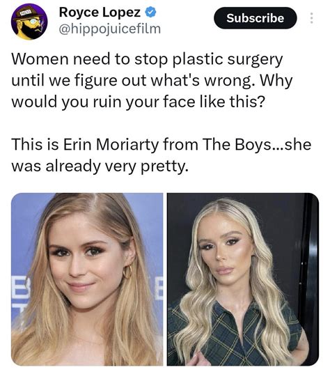 Anyone else have the headcanon that Starlight actually got plastic surgery in the show? : r/TheBoys