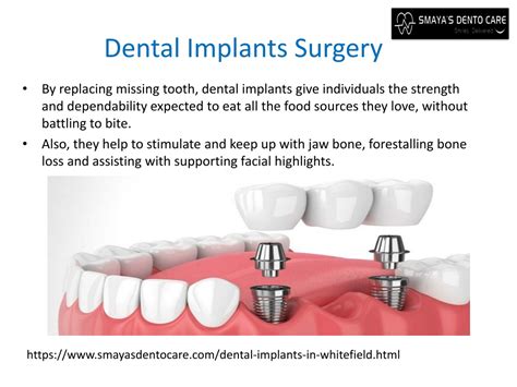 PPT Dental Implants In Whitefield Dental Implants Surgery PowerPoint