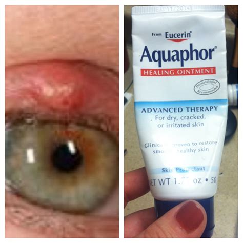 Can I Put Aquaphor On My Lashes