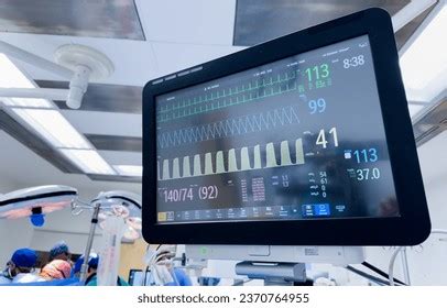 Medical Monitor Displays Vital Signs Graphs Stock Photo 2370764955