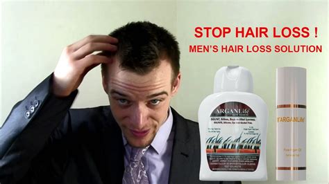 Stop Hair Loss Mens Hair Loss Solution Review Youtube