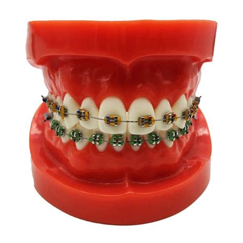 Buy Fhuili Dental Orthodontic Demonstration Model Dental Teeth Study