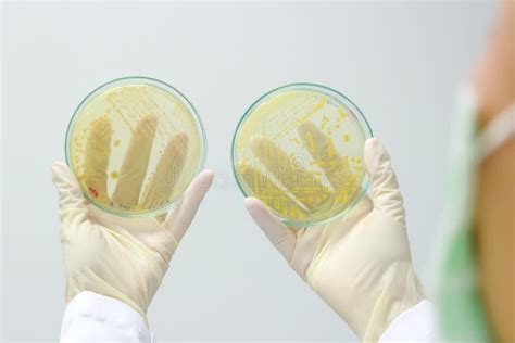 Microbiologists Hand Holding Petri Dish With Growing Cultures Of