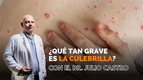 Qu Tan Grave Es La Culebrilla O Herpes Z Ster Parte M Dico Con El