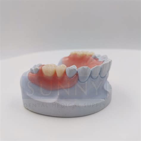 Flexible Denture Valplast® Sunny Dental Medical Supply