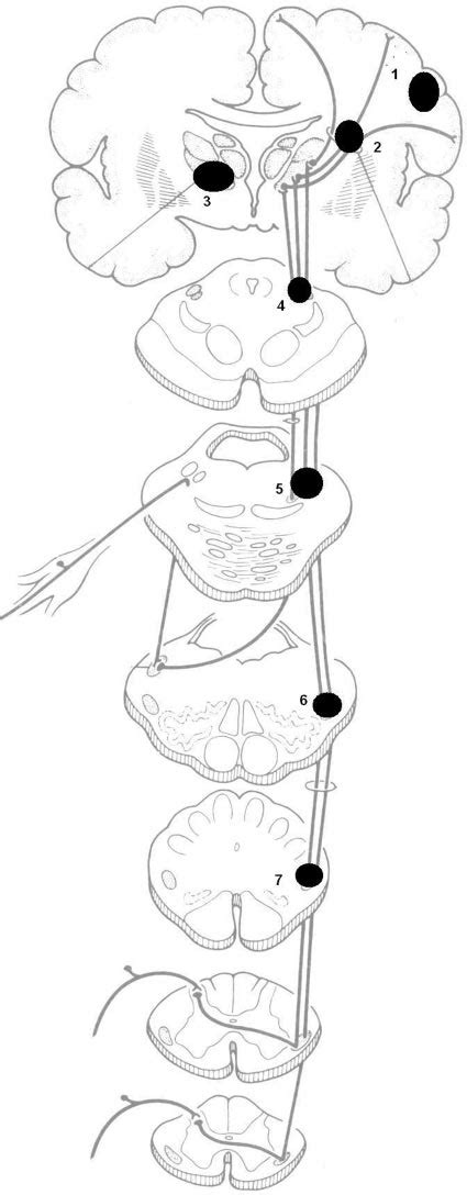 Schematic Diagram Shows The Various Locations Of Stroke Producing