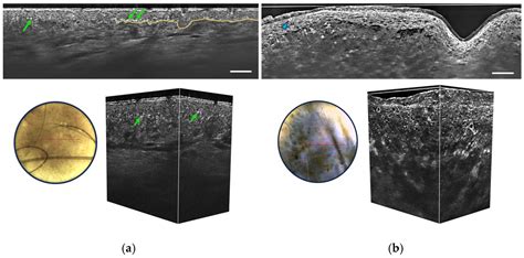 Life Free Full Text Line Field Confocal Optical Coherence