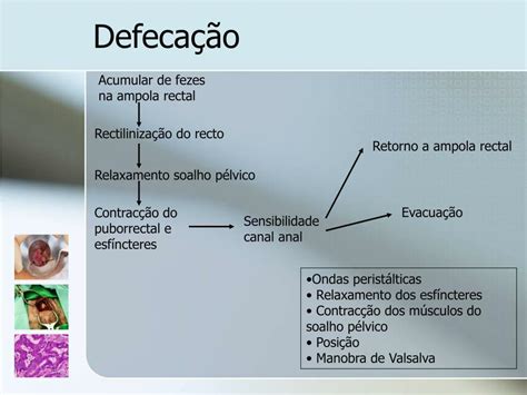 Ppt Patologia Perianal Powerpoint Presentation Free Download Id 829116