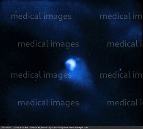 STOCK IMAGE, , BY4625, 01B4599W , Science Source - Search Medical ...