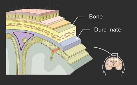 Imagenología De La Cabeza Y El Cerebro Concise Medical Knowledge