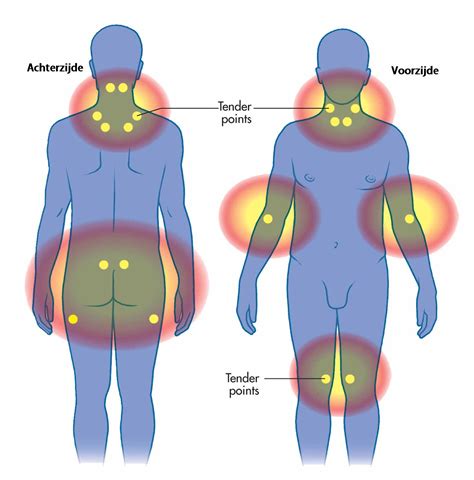 Fibromyalgie Behandeling Dharma Health