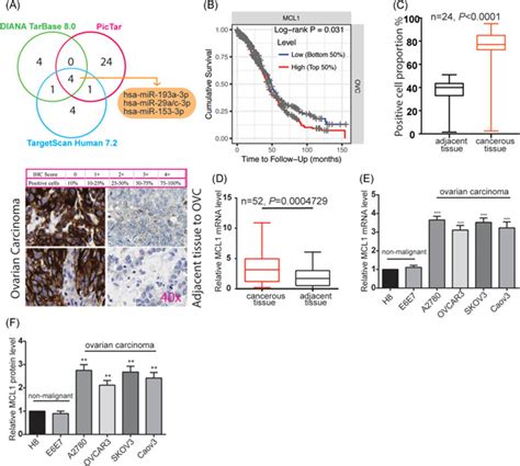 Mir P Regulates Progression Of Ovarian Carcinoma In Vitro And In