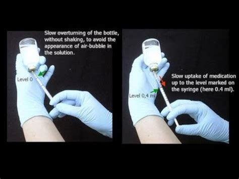 Aseptic Technique Procedures In IV Preparation Area YouTube