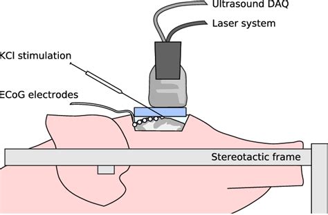 Setup For Characterizing Spreading Depolarization Sd Deep Inside The