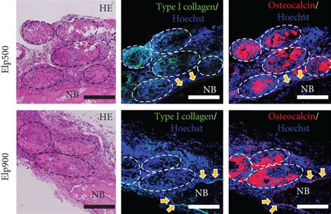 Comparative Bone Regeneration Capacity Of OI IPSC Constructs Fabricated