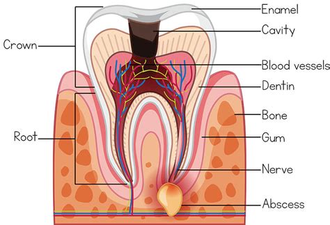 Dental Abscess Treatment Trusted Cambridge Dentist