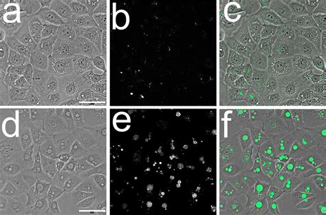 Apoptosis Paraptosis And Autophagy Death And Survival Pathways