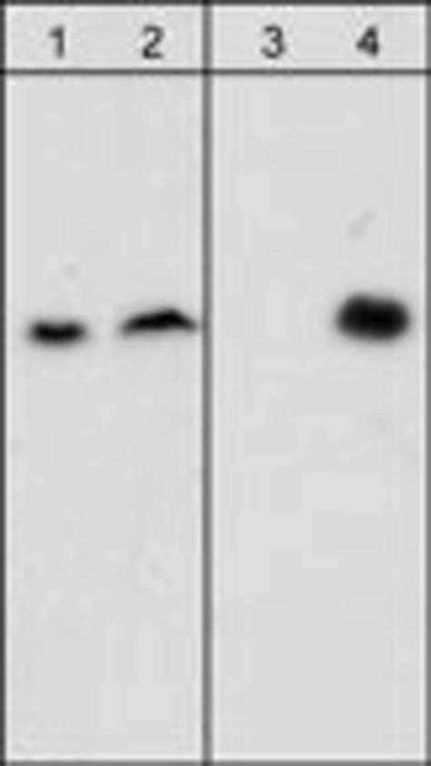 Phospho Beta Dystroglycan Tyr892 Monoclonal Antibody M117