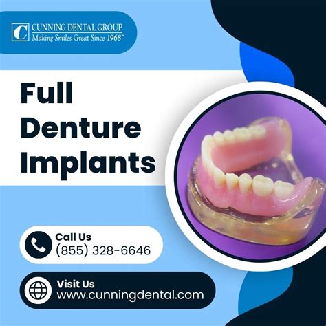 Screw In Teeth Denture Implants Cunning Dental Group Medium