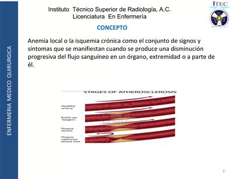 Isquemia De Miembros Inferiores PPT