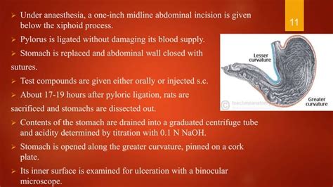 Screening Methods Of Antiulcer Agents Ppt