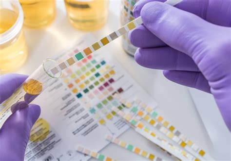 10 Panel Drug Tests Checkr