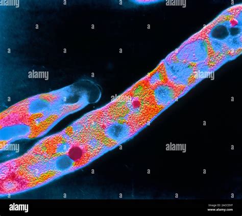 False Colour Transmission Electron Micrograph Tem Of A Rod Like