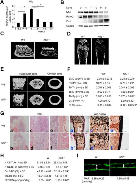 Nfic Disruption Impairs Bone Formation During Postnatal Osteogenesis