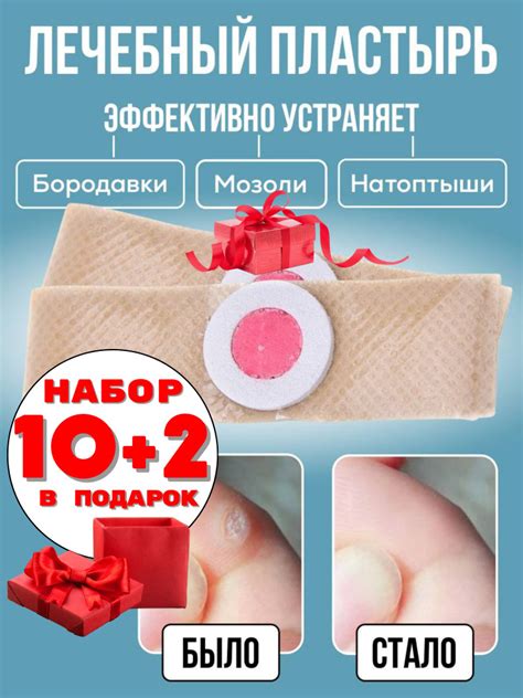 Пластырь для удаления мозолей, натоптышей, бородавок, 10+2 шт ...