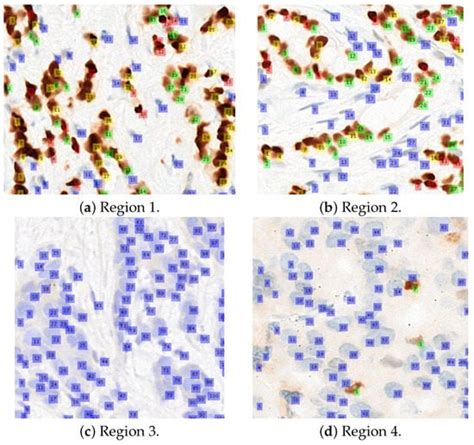 Diagnostics Free Full Text Allred Scoring Of Er Ihc Stained Whole