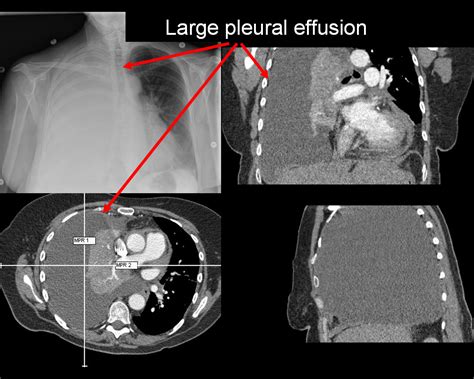 On Call Radiology Common Radiology Findings On Call And In The