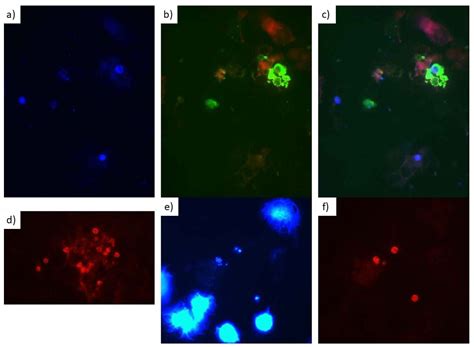 Jof Free Full Text Identification Of Pneumocystis Jirovecii With Fluorescence In Situ