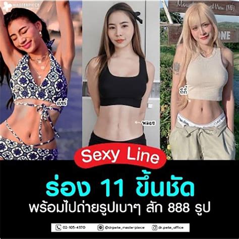 ทำ Sexy Line เอว S ด้วยการดูดไขมัน