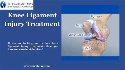 PPT - Knee Ligament Injury Treatment PowerPoint Presentation, free ...