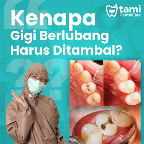 Kenapa Gigi Berlubang Harus Ditambal Tami Dental Care Klinik Dokter