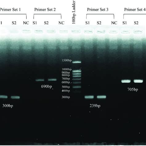 Agarose Gel Electrophoresis Of The Amplicons Generated From Pcr Using Download Scientific