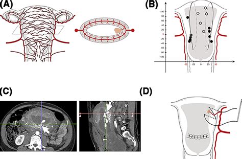 Schema Of Bleeding Point And Hemostatic Suture A Schema Of The Supply Download Scientific