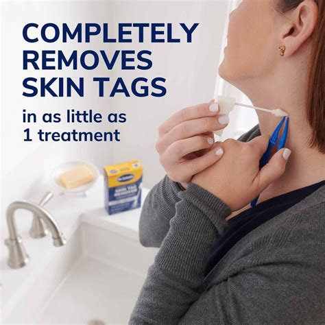 Scholl Freeze Away Skin Tag Remover Murrays Health And Beauty Paul