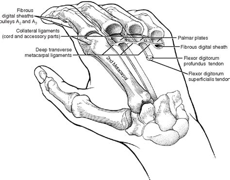 Figure 13 From The Unstable Metacarpophalangeal Joint In Rheumatoid