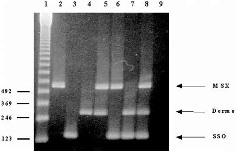 Agarose Gel Electrophoresis Of Multiplex Pcr Amplified Products