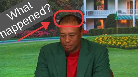 Tiger Woods Winning Interview Balding Tiger Hidden Problems Youtube