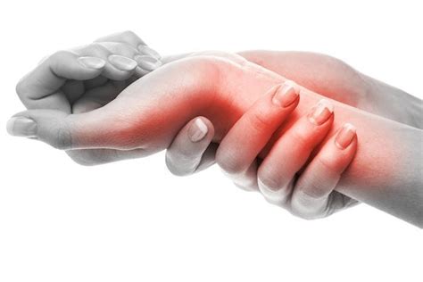 Tips For Managing Carpal Tunnel Pain Dr Louis Keppler And Associates