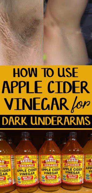 How To Use Apple Cider Vinegar For Dark Underarms 9 Diy Methods Skin Disease Remedies