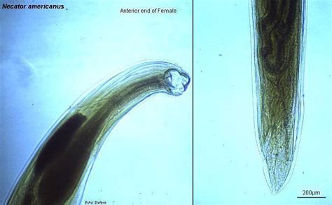 Necator Americanus Mucro Del Verme Adulto Hembra