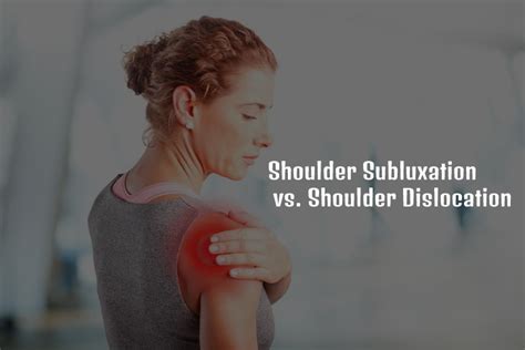 Shoulder Subluxation vs. Shoulder Dislocation: What's Best For You ...