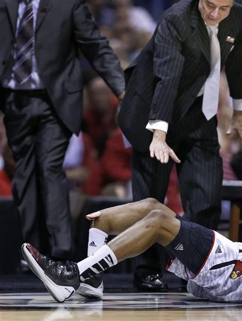 Basketball Player Kevin Ware Suffers Compound Fracture Of Tibia Rnsfl