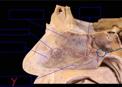 Nasal Cavity 2 Pterygopalatine Fossa Flashcards Quizlet