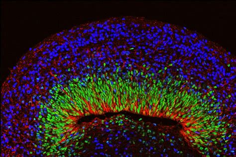 Photo Organoid Image Ucla Ucla